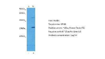 Western Blot: GFI1B Antibody [NBP2-84040]