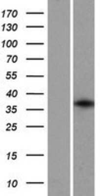 Western Blot: GFI1B Overexpression Lysate [NBP2-07900]