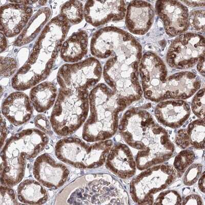 Immunohistochemistry: GFM1 Antibody [NBP2-38221]