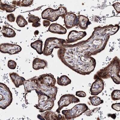 Immunohistochemistry-Paraffin: GFM1 Antibody [NBP1-83997]