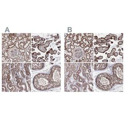 Immunohistochemistry-Paraffin: GFM1 Antibody [NBP1-83997]
