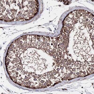 Immunohistochemistry-Paraffin: GFM1 Antibody [NBP1-83997]