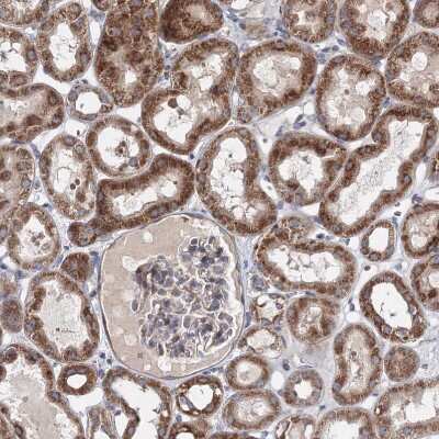 Immunohistochemistry-Paraffin: GFM1 Antibody [NBP1-83997]