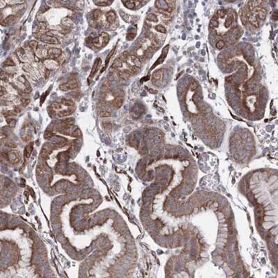 Immunohistochemistry-Paraffin: GFM1 Antibody [NBP1-83997]