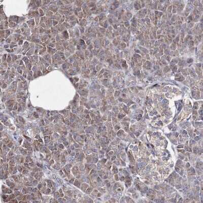 Immunohistochemistry-Paraffin: GFM1 Antibody [NBP2-38221]