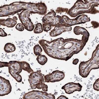Immunohistochemistry-Paraffin: GFM1 Antibody [NBP2-38221]