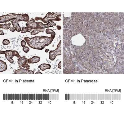 Immunohistochemistry-Paraffin: GFM1 Antibody [NBP2-38221]