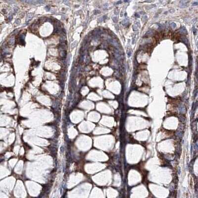 Immunohistochemistry-Paraffin: GFM1 Antibody [NBP2-38221]