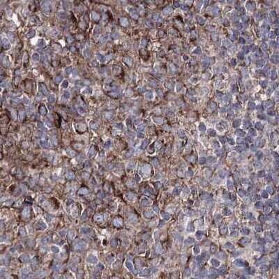 Immunohistochemistry-Paraffin: GFM1 Antibody [NBP2-38221]