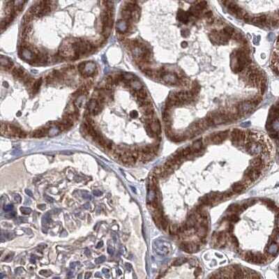 Immunohistochemistry-Paraffin: GFM1 Antibody [NBP2-38221]