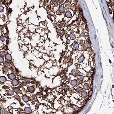 Immunohistochemistry-Paraffin: GFM1 Antibody [NBP2-38221]