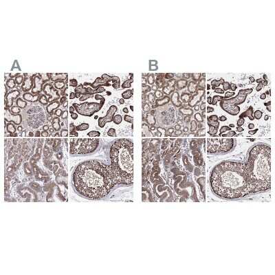 Immunohistochemistry-Paraffin: GFM1 Antibody [NBP2-38221]