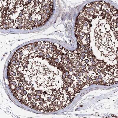 Immunohistochemistry-Paraffin: GFM1 Antibody [NBP2-38221]