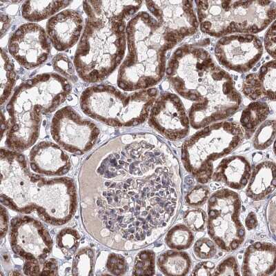 Immunohistochemistry-Paraffin: GFM1 Antibody [NBP2-38221]