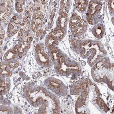 Immunohistochemistry-Paraffin: GFM1 Antibody [NBP2-38221]