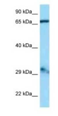 Western Blot: GFM1 Antibody [NBP1-98457]