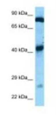 Western Blot: GFM1 Antibody [NBP1-98458]