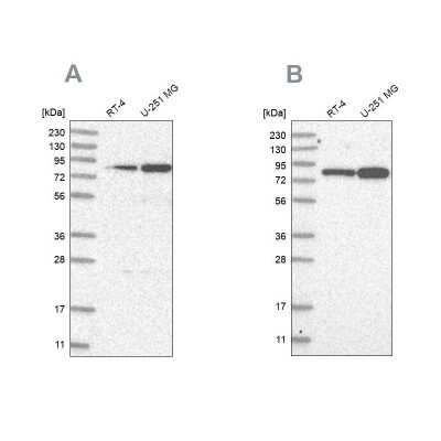 Western Blot: GFM1 Antibody [NBP2-38221]