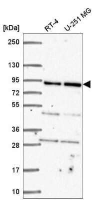 Western Blot: GFM1 Antibody [NBP2-55712]