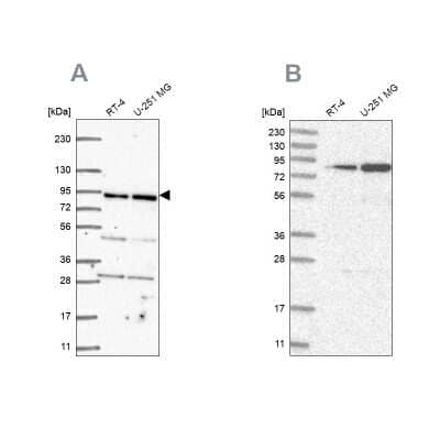 Western Blot: GFM1 Antibody [NBP2-55712]