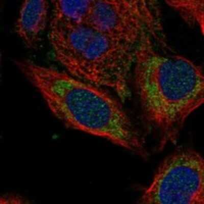 Immunocytochemistry/ Immunofluorescence: GFM2 Antibody [NBP3-17253]