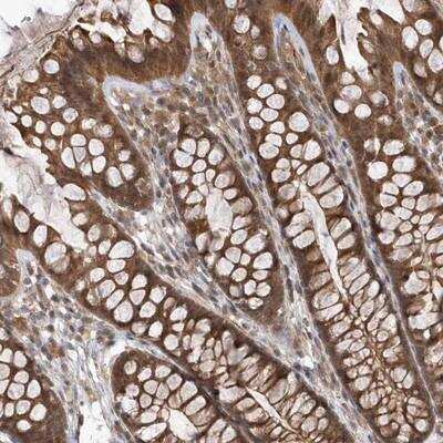 Immunohistochemistry: GFM2 Antibody [NBP2-14043]