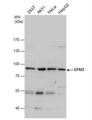 Western Blot: GFM2 Antibody [NBP2-16646]