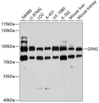 Western Blot: GFM2 AntibodyBSA Free [NBP3-05090]