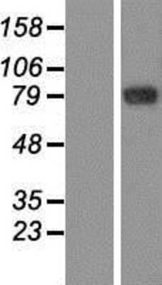 Western Blot: GFM2 Overexpression Lysate [NBP2-06041]