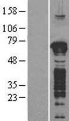 Western Blot: GFOD1 Overexpression Lysate [NBP2-04374]