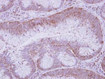 Immunohistochemistry-Paraffin: GFOD2 Antibody [NBP2-16647]