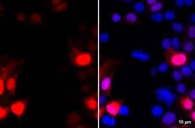 Immunocytochemistry/ Immunofluorescence: GFP Antibody (859) [NBP2-43575]