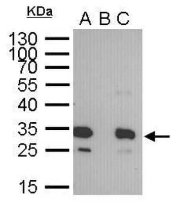 Immunoprecipitation: GFP Antibody (859) [NBP2-43575]