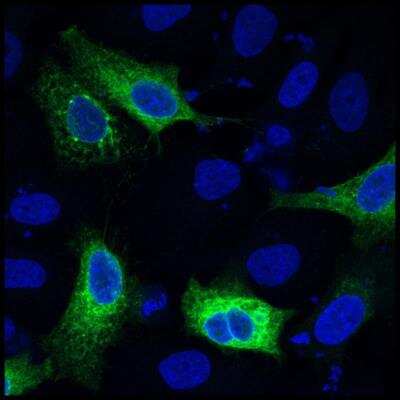 Immunocytochemistry/ Immunofluorescence: GFP Antibody [NB100-1614]