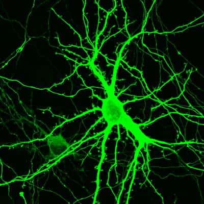 Immunocytochemistry/ Immunofluorescence: GFP Antibody [NB100-1614]