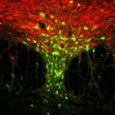 Immunocytochemistry/ Immunofluorescence: GFP Antibody [NB100-1614]