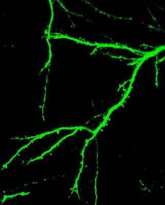 Immunofluorescent Staining of GFP in Mouse Brain