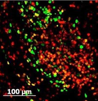 Immunocytochemistry/ Immunofluorescence: GFP Antibody [NB600-303]