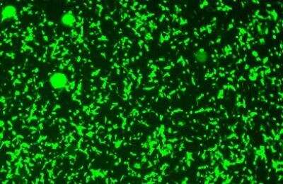 Immunocytochemistry/ Immunofluorescence: GFP Antibody [NB100-1614]