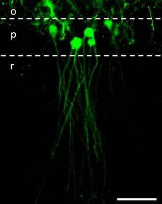 Immunohistochemical Detection of GFP in Transplanted NPCs