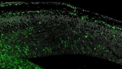 Immunohistochemistry-Paraffin: GFP Antibody [NB100-1614]