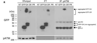 Western Blot Detection of GFP in Transfected HeLa Cells