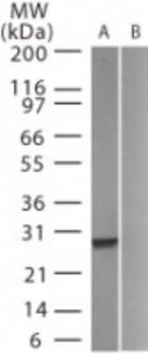 Western Blot: GFP Antibody [NB100-56401]