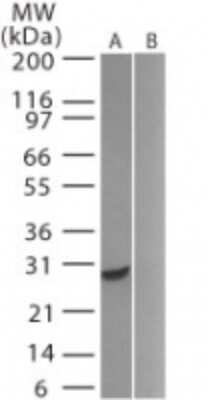 Western Blot: GFP Antibody [NB100-56402]