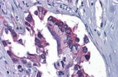 Immunohistochemistry-Paraffin: GFPT1 Antibody [NBP3-14334]