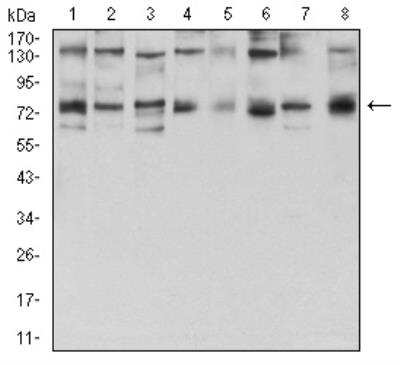 Western Blot: GFPT1 Antibody (1F1B9)BSA Free [NBP2-52474]