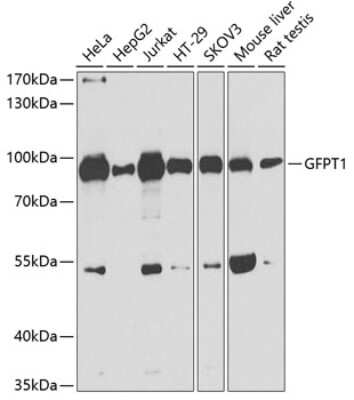 Western Blot: GFPT1 AntibodyBSA Free [NBP3-04455]