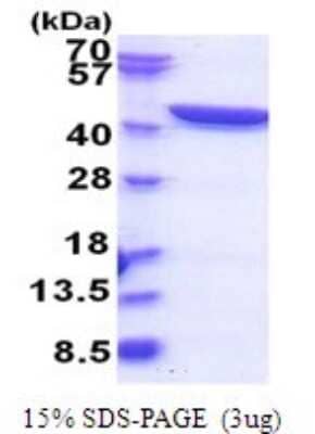 SDS-PAGE: Recombinant Human GFPT1 His Protein [NBP2-51789]