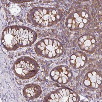 Immunohistochemistry: GFPT2 Antibody [NBP2-38811]