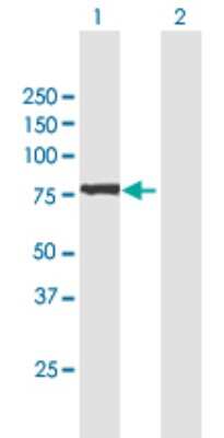 Western Blot: GFPT2 Antibody [H00009945-B01P]